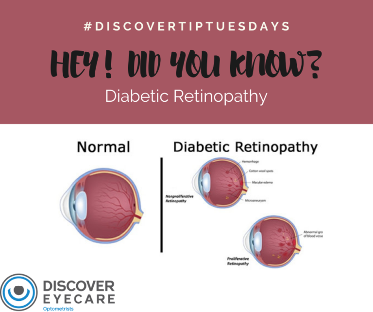 Did You Know: Diabetic Retinopathy