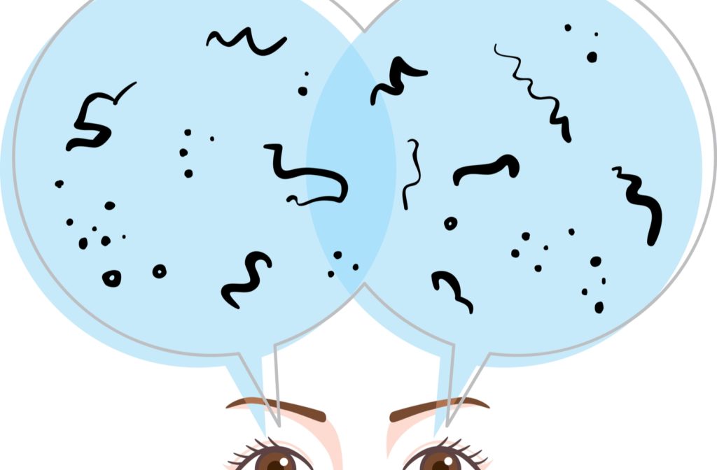 Illustration of two eyes with eyebrows and a blue circle above them filled with black shapes of eye floaters.