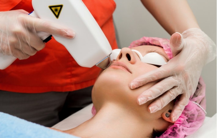 A woman at her optometrist getting Intense Pulsed Light Therapy for her dry eye