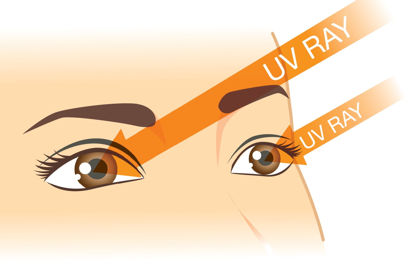 An illustration of eyes getting sunburned from the Uv rays from the sun