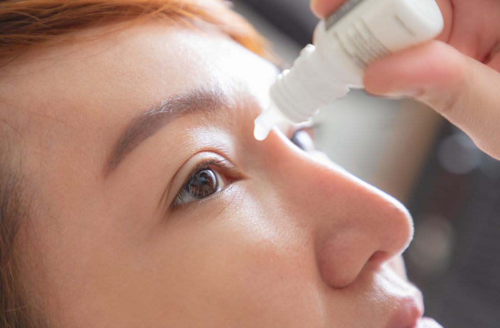 Closeup view of a young woman applying artificial tear eye drops to treat sunburned eyes