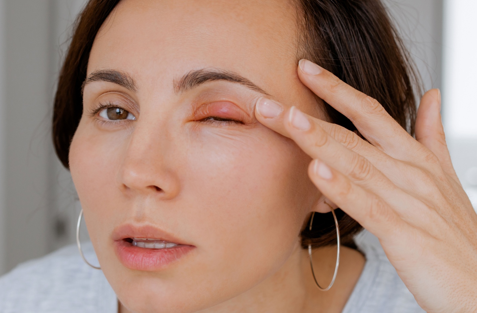 A woman carefully inspects a stye that appears as red bump on her eyelid