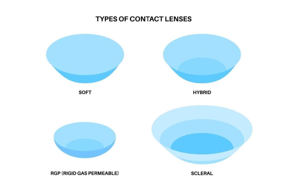 Illustration showing four types of contact lenses—soft, hybrid, rigid gas permeable (RGP), and scleral—used for different vision and comfort needs at Discover Eyecare.